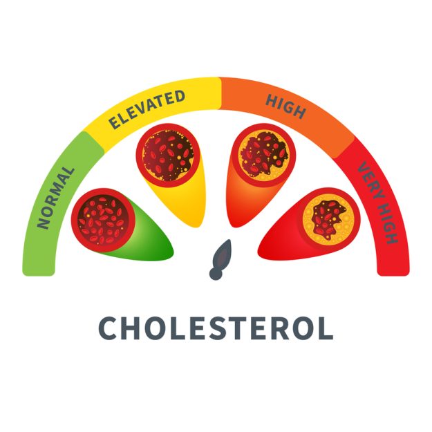 Cholesterol level meter gauge with blood vessel diagram