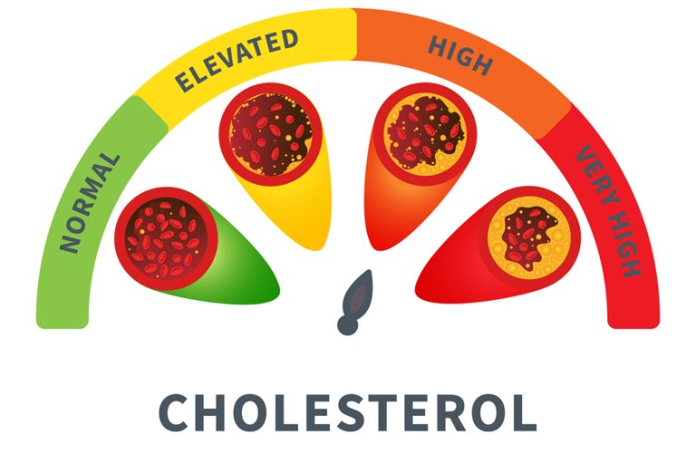 Cholesterol level meter gauge with blood vessel diagram